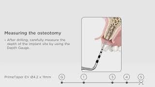 PrimeTaper Surgical Animation