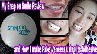 Snap On Smile Review | How Do I Make Fake Veneers Using Its Adhesive