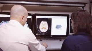 Diagnosing Alzheimer's with PET Scans - Yale Medicine Explains