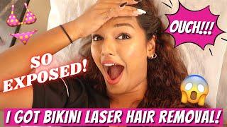 I got Bikini Laser Hair Removal | DONE AT HOME! Insane results