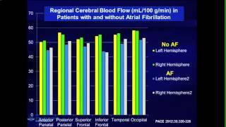 AF and Dementia: Can Dementia be Prevented in AF Patients?