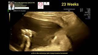 23 weeks