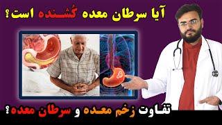 آیا سرطان معده کشنده است  Does Stomach Cancer Kills, Stomach pain, Ulcer and cancer difference