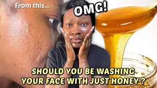 OMG! I Washed my Face with HONEY everyday for one week and this happened! | Honey cleansing #honey