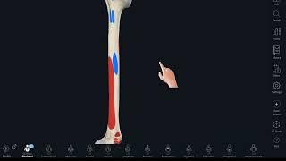 Muscle attachments of humerus-3D demonstration.