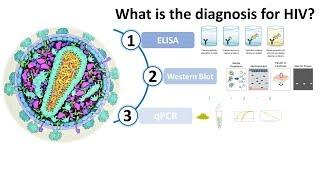 Diagnosis of HIV AIDS