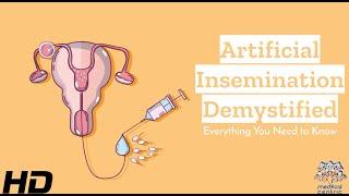 Artificial Insemination Explained: Making Informed Choices