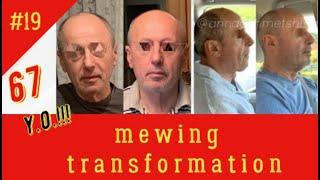 MEWING TRANSFORMATION AFTER 40!!! 