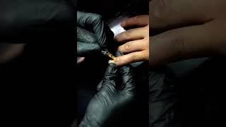 Vitiligo skin color tattoo coverup | Vitiligo skin disease treatment