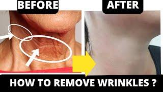  STOP TURKEY NECK  and NECK WRINKLES ! ANTI-AGING FACE EXERCISES FOR NECK & CHEST | FULL COLLECTION