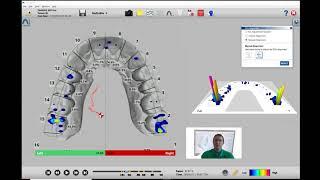 How to Use Intraoral Scanner Files in T-Scan Software