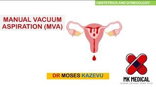 Manual Vacuum Aspiration (MVA)