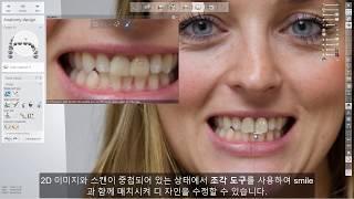 3Shape 덴탈시스템 - Realview engine - 3Shape Dental System - Realview engine
