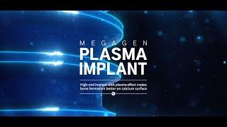 Plasma X Plasma Implant