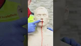 First Aid for Nosebleeds 🩸 #ambulance #firstaid #paramedic #hospital #emergency #nurse