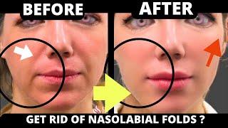 FACIAL EXERCISES FOR NASOLABIAL FOLDS (LAUGH LINES) JOWLS, SAGGY SKIN, JAWLINE, FOREHEAD #skincare