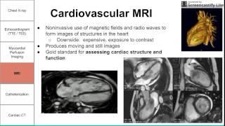Cardiac Imaging Modalities