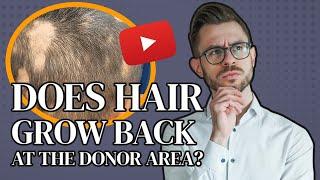 Donor Area Hair Regrowth After Hair Transplant: Fact or Fiction?