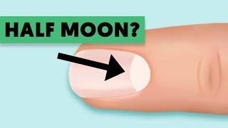 Warning! Do You Have That Half Moon Shape On Your Nails?