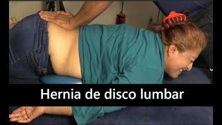 Hernia de disco | Hernias de disco L4-L5, L5-S1 