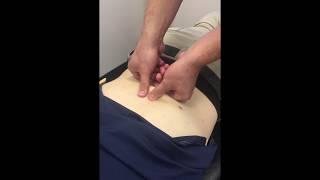 Fairfax VA Chiropractor Performs Skin Rolling on Low Back Fascia