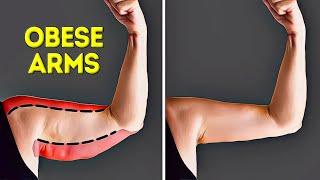 10 MINUTES BURN OBESE ARMS | NO MORE BULKY ARMS