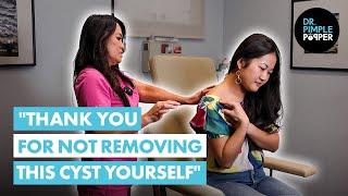 "Thank You for Not Removing this Cyst Yourself": Dr. Lee Meets J Before Her Cyst Procedure