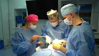 Вроджений дефект верхньої губи | Дмитро Слоссер у програмі «Реальна хірургія»
