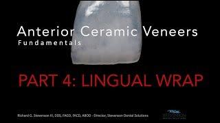 Anterior Ceramic Veneers, Part 4:  Lingual Wrap