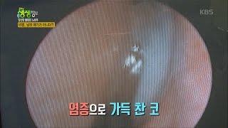 2TV 생생정보 - ‘환절기 불청객’ 비염, 예방 방법은?!.20161104