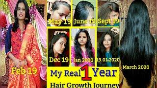 My Real 1 Year Hair Growth Journey With Pictures Before After | How I Grow My Hair | Shinny Roops