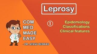 Leprosy | Part- 1 | Epidemiology, Clinical Features, Classification | CMME |