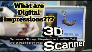 What are Digital Impressions??? 3D Intra Oral Scanners | Dr.Arunkumar | Pearls Dentistry