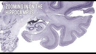 Zooming in on the hippocampus