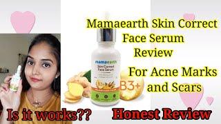 Mamaearth Skin Correct Face Serum Review | Get rid of acne scar and pimple marks| Honest Review