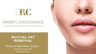Buccal Fat Removal | Ramsey Choucair, M.D. | Dallas, TX | Ph: 214-389-9797