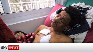 Yemen Conflict: The war's forgotten victims