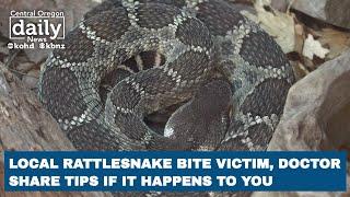 Rattlesnake bites: Central Oregon victim, doctor share what to do if it happens to you