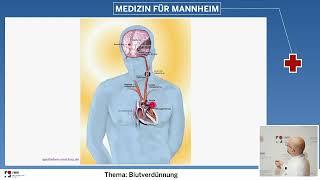 Blutverdünnung - Wer braucht welche Blutverdünner?