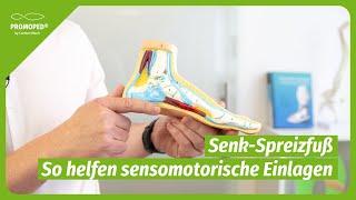 Senk-Spreizfuß - Die häufigste Fußfehlstellung Deutschlands