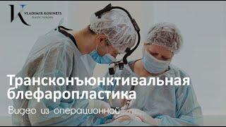 Трансконъюнктивальная блефаропластика - пластический хирург Владимир Косинец