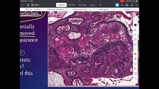 PBL 1 (part2 ) endicrine system | طب القادسية