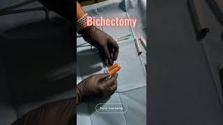 Face Contouring and Bichectomy:  Removal Bichat from Asymmetrical Face