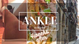 ANKLE SURGERY: How's the recovery after 4 weeks? #orif #brokenbone #anklesurgery