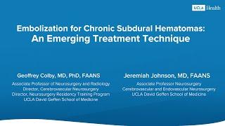 MMA Embolization: An Emerging Treatment Technique for Chronic Subdural Hematomas | UCLA Health