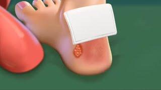 ASMR: Satisfying Patient Treatment Maggot Removal, Athlete's foot cleaning for mood relaxation