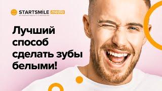 Виниры или отбеливание зубов? Все плюсы и минусы