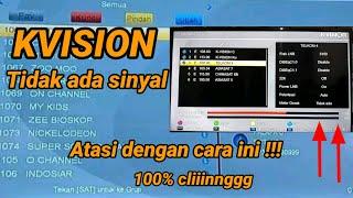 KVISION tidak ada sinyal di jamin mudah teratasi