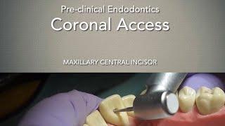 Coronal Access (Maxillary Central Incisor)