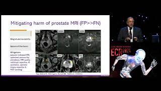 ECR 2024 PI-RADS Update - What is next?